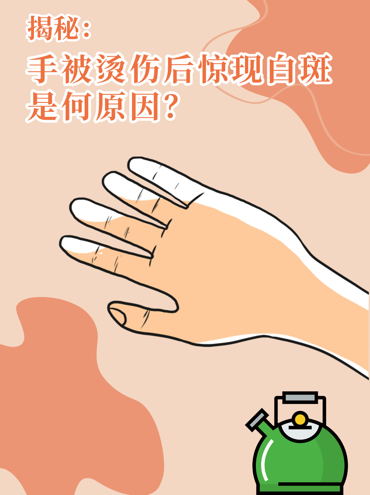 是一名专职宝妈👩,记得是两个月前,我在做饭的时候不小心将手烫伤了