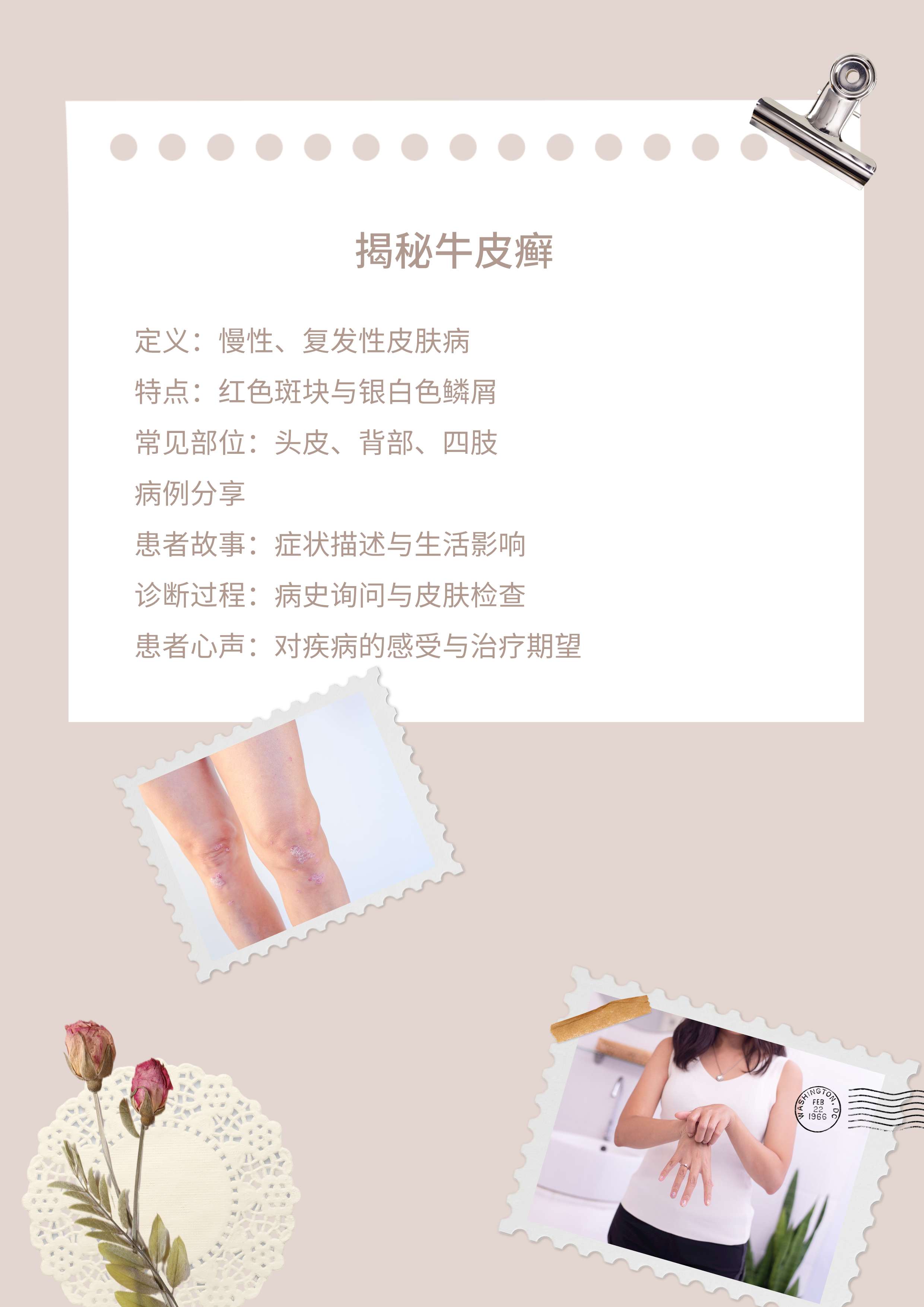 【揭秘牛皮血癣】它是什么样子,又该如何治疗?