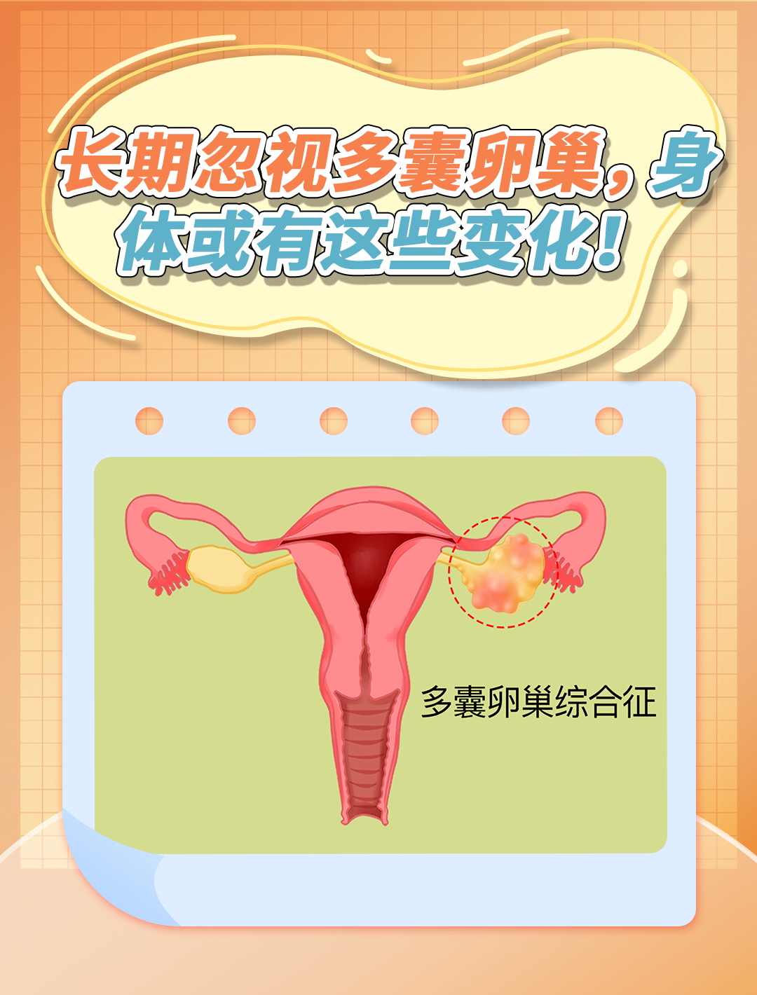 长期忽视多囊卵巢,身体或有这些变化!