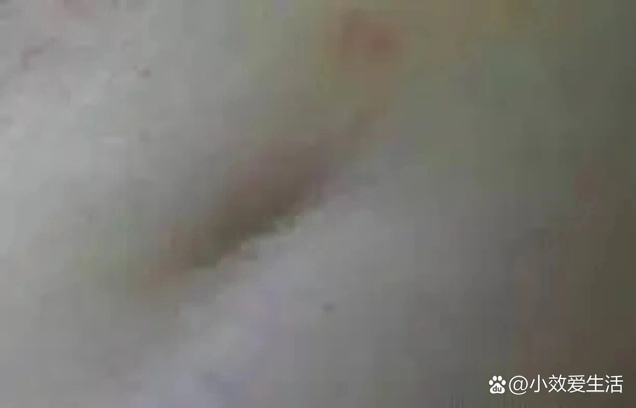 乳房酒窝是什么样子图片