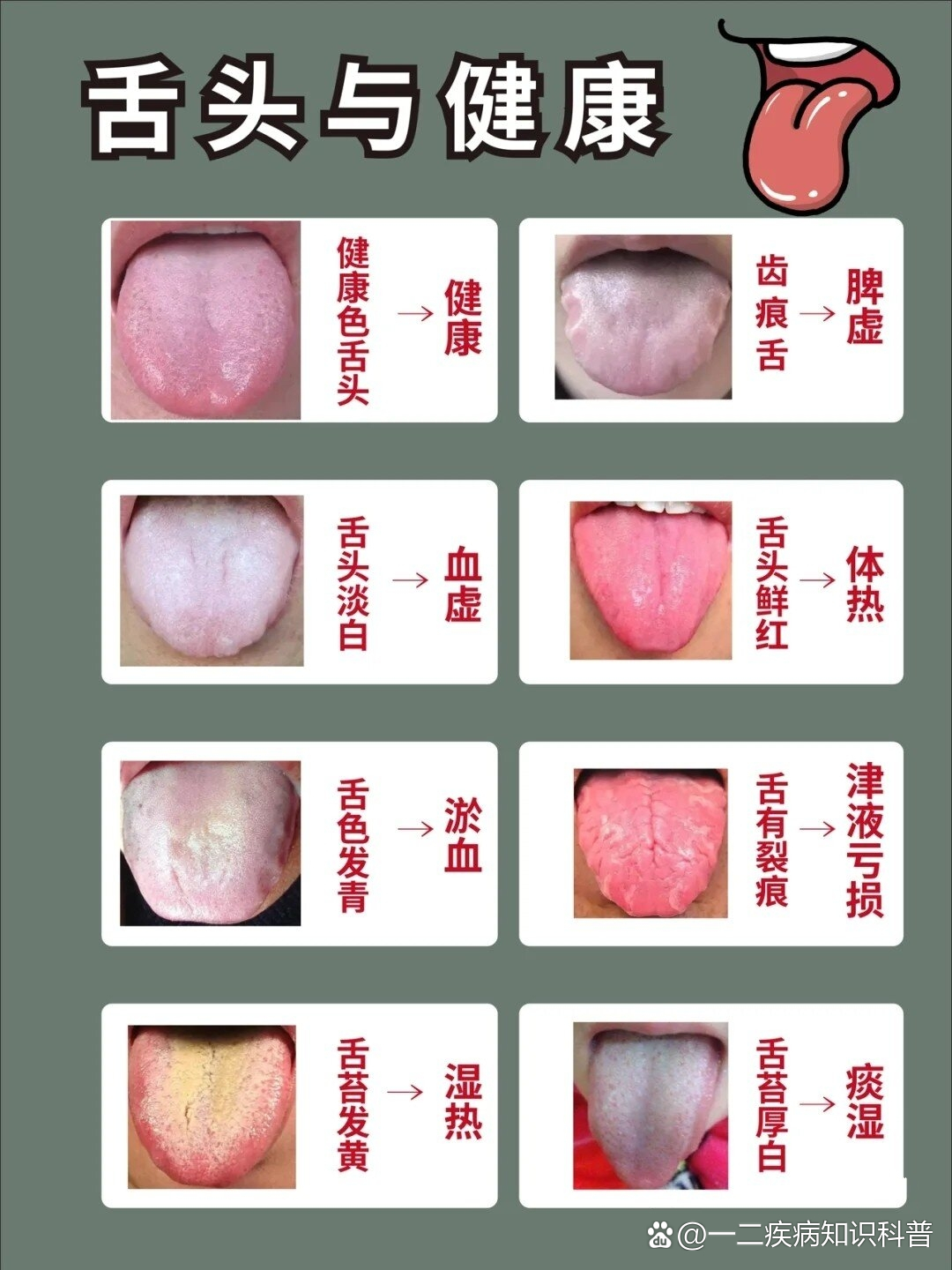 舌头与健康|看舌象知健康