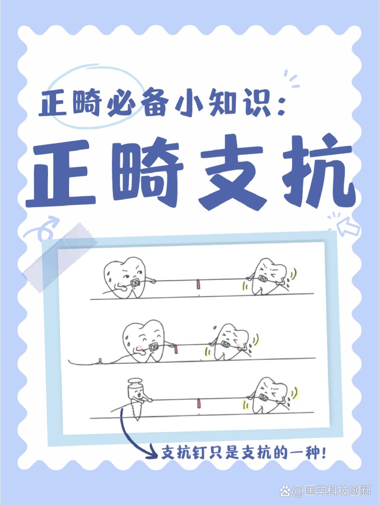 正畸必备小知识:正畸支抗