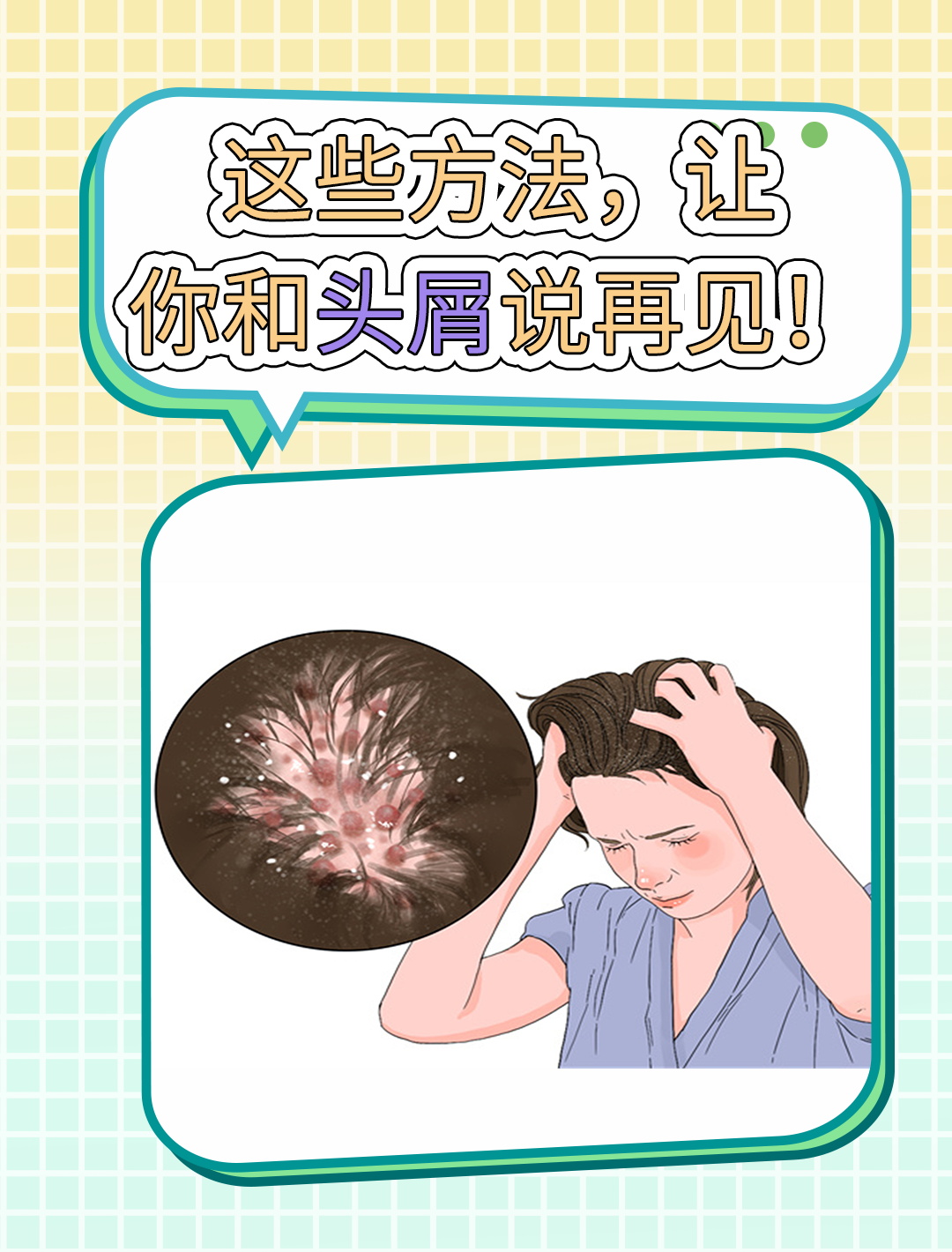 10个小妙招教你告别头皮屑!