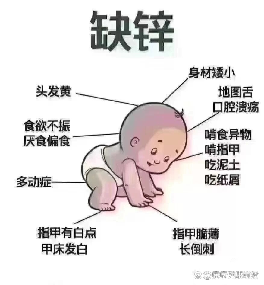 孩子有这些症状时,注意可能是缺锌了