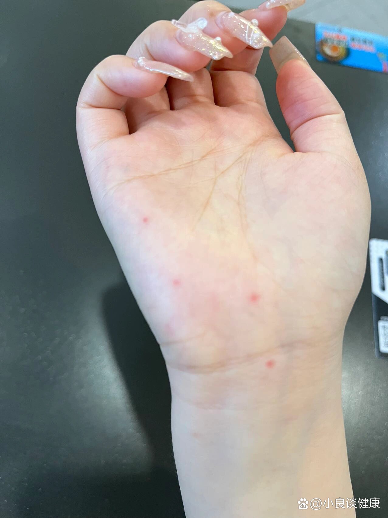 手上突然冒出好多小红点