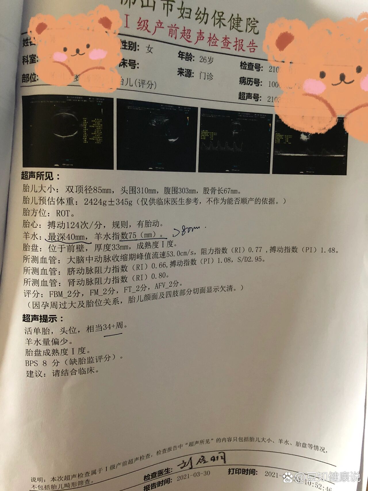 生娃遇到胎盘早剥是一种什么样的体验?