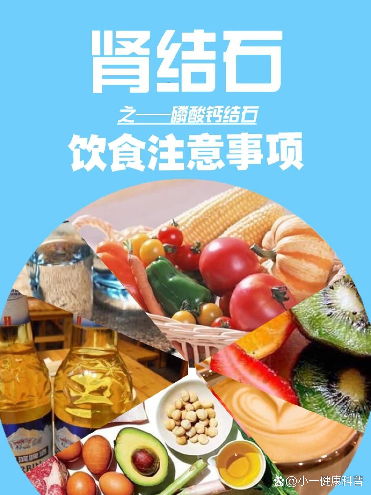 肾结石吃什么 全网资源