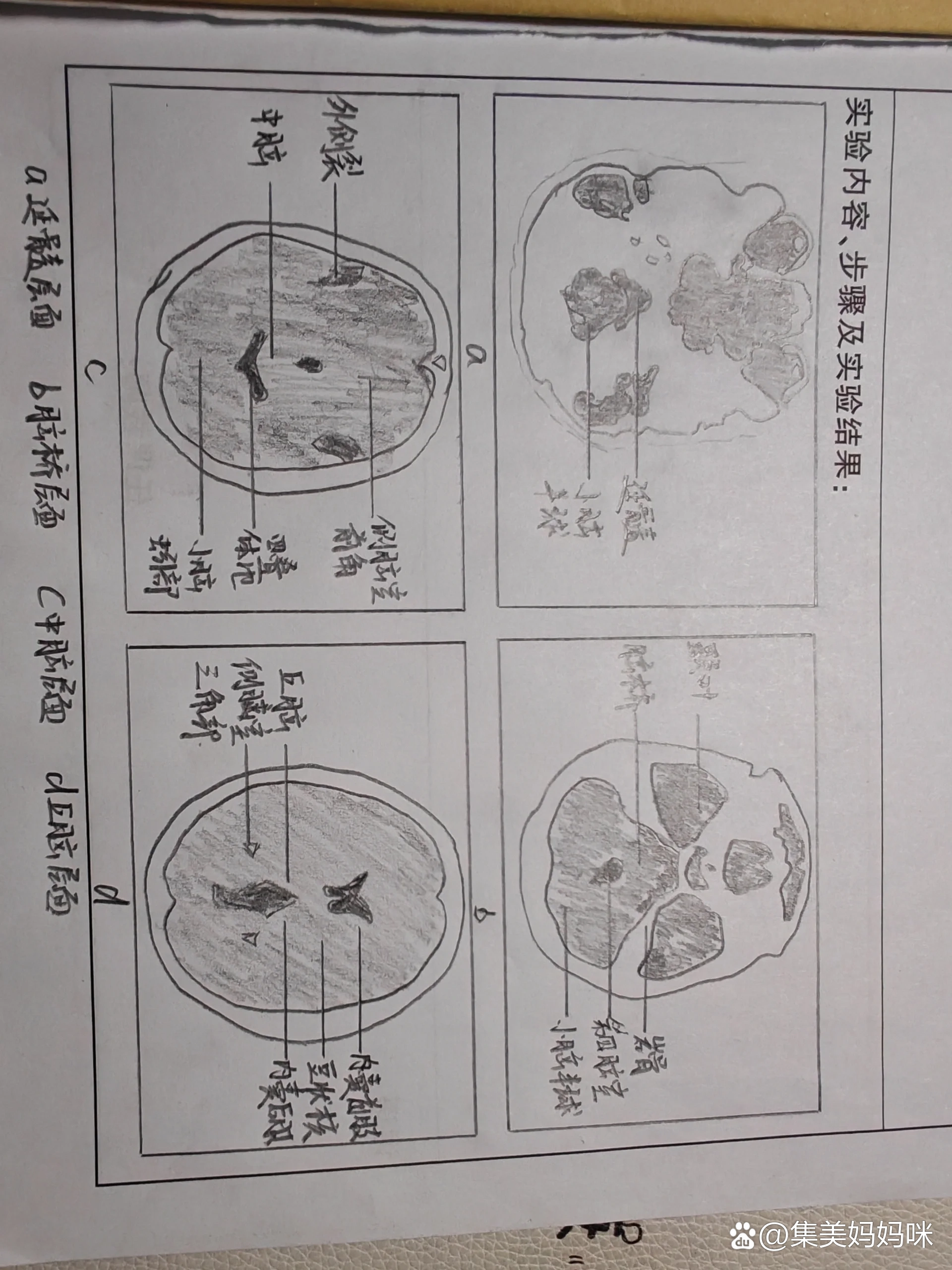 脑正常ct图