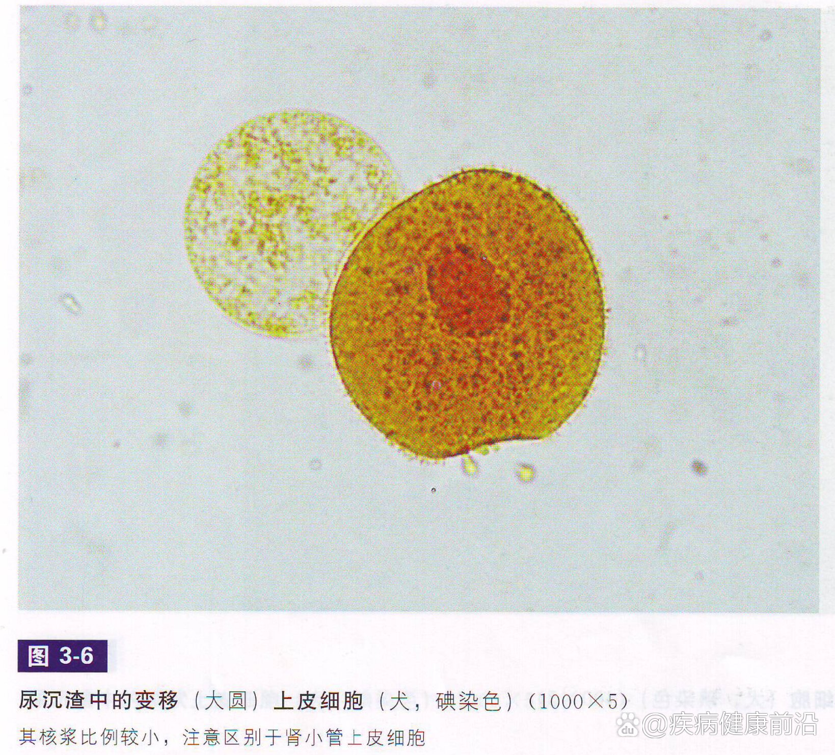 狗附红细胞体图片