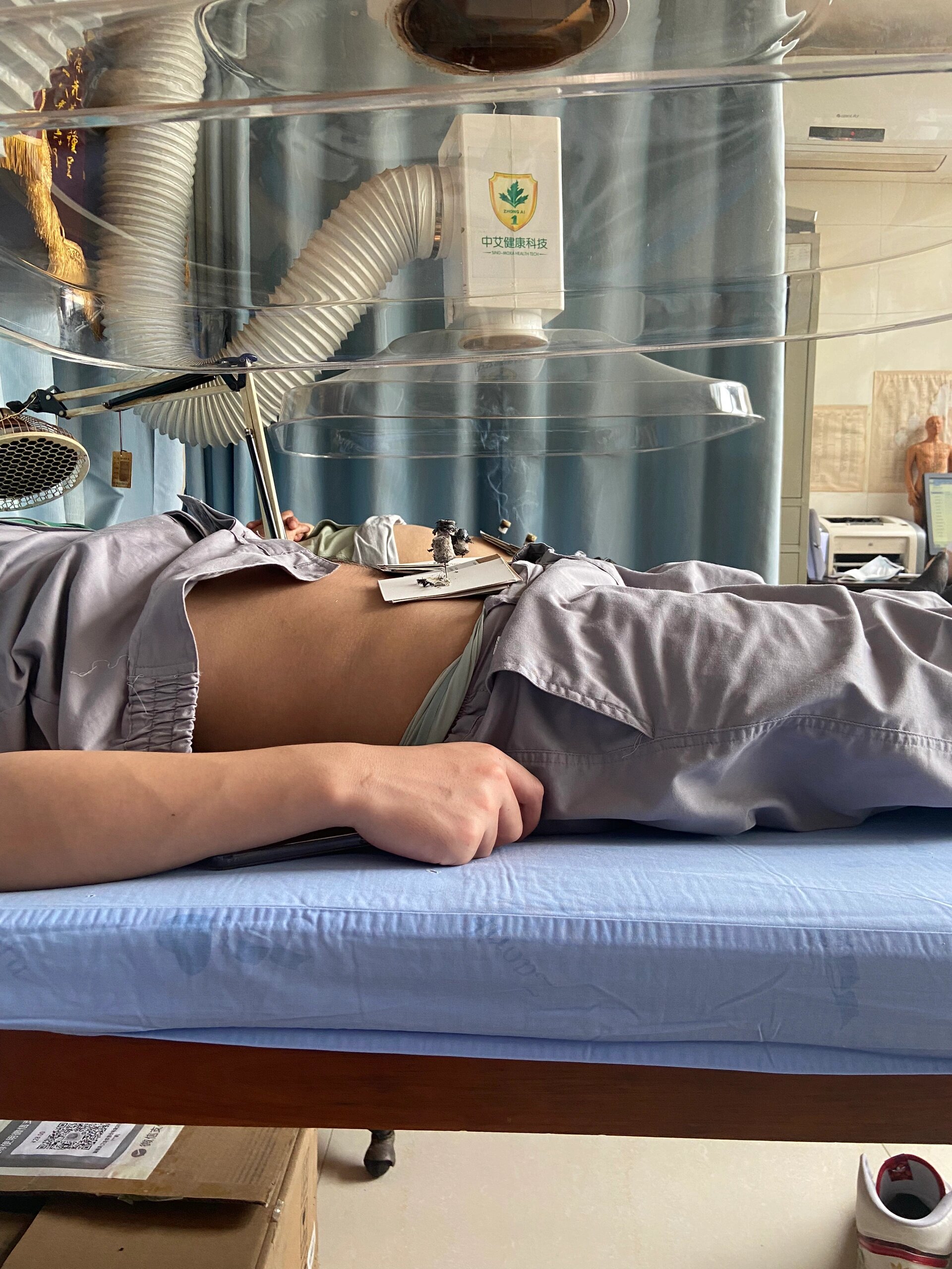 中医传统针灸治疗男性疾病