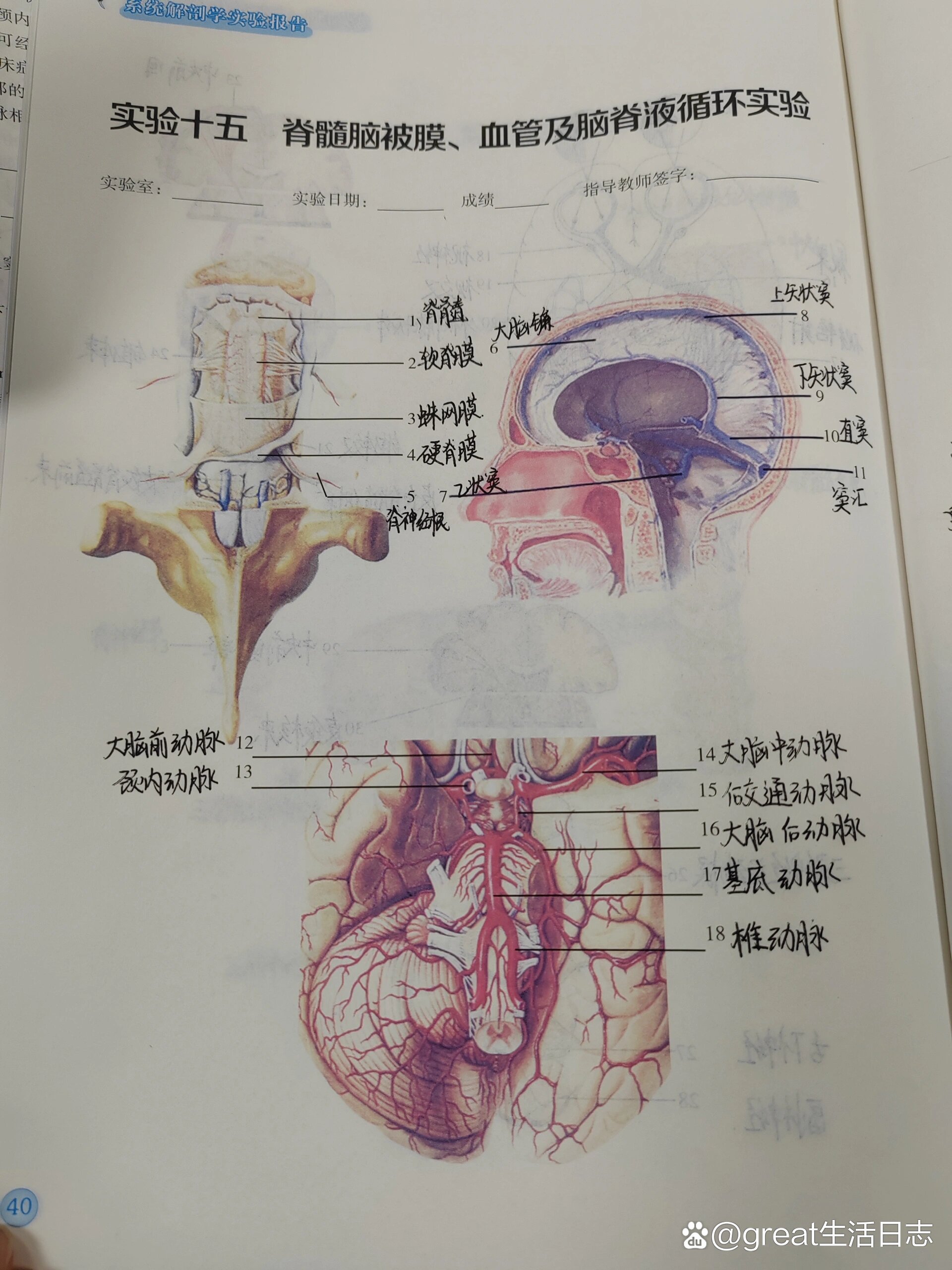 合体实验解剖图图片