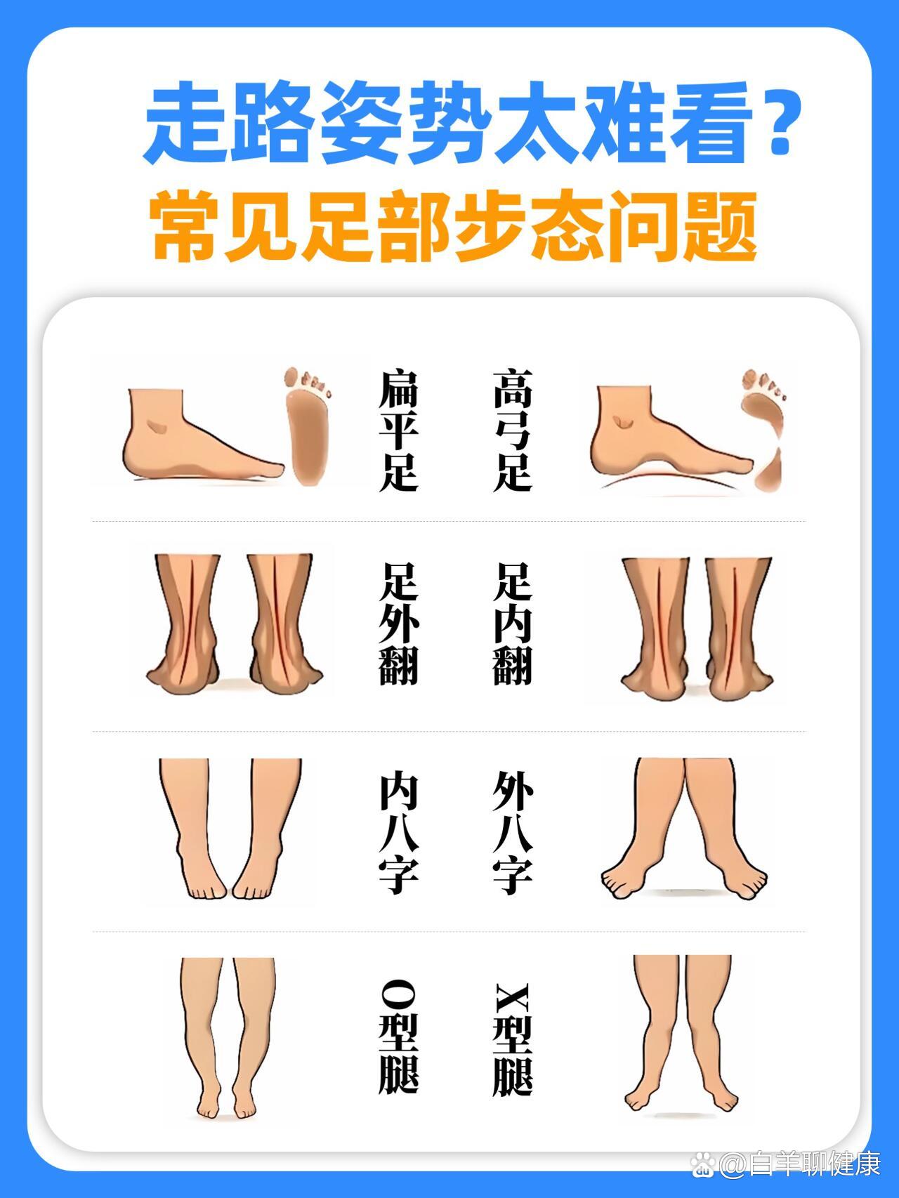 正确走路的姿势脚掌图片