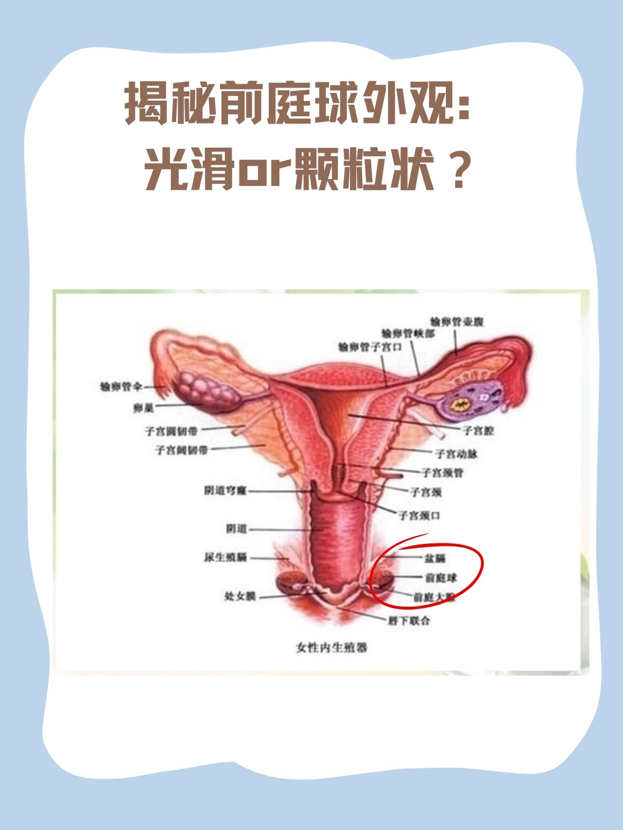 前庭沟位置图片