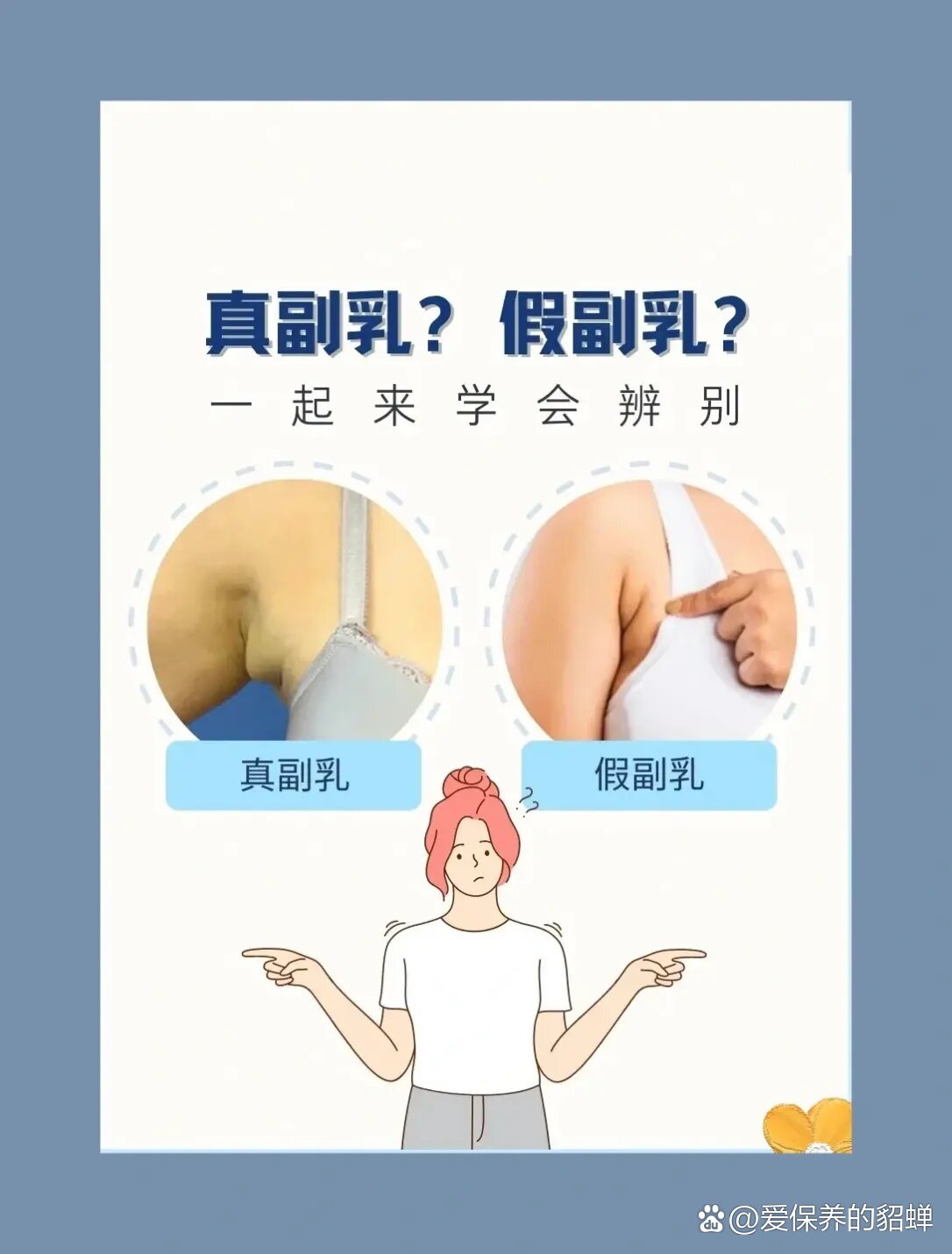 副乳也有真假?