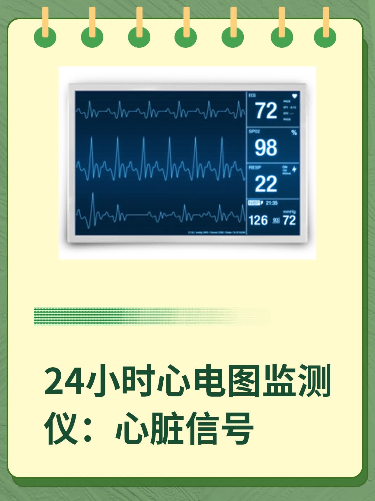 24小时心电图监测仪:心脏信号