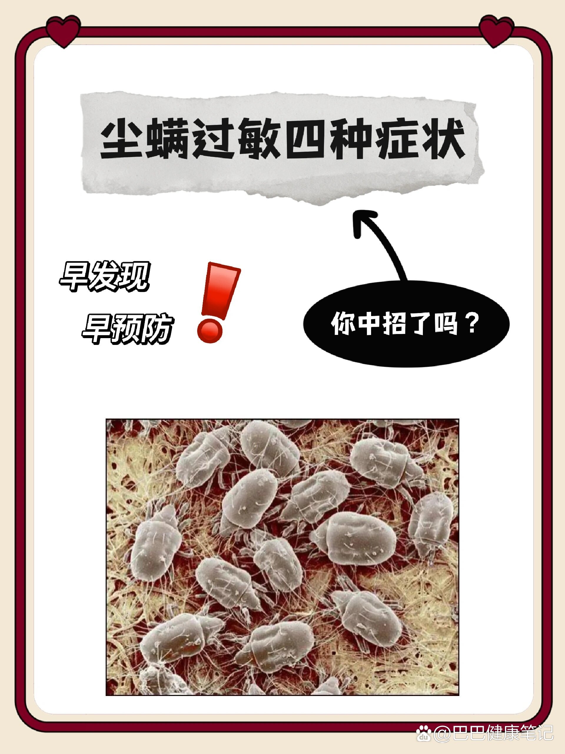  br>把很多症状都归类为小毛病  br>那尘螨过敏到底有哪些症状呢  br>