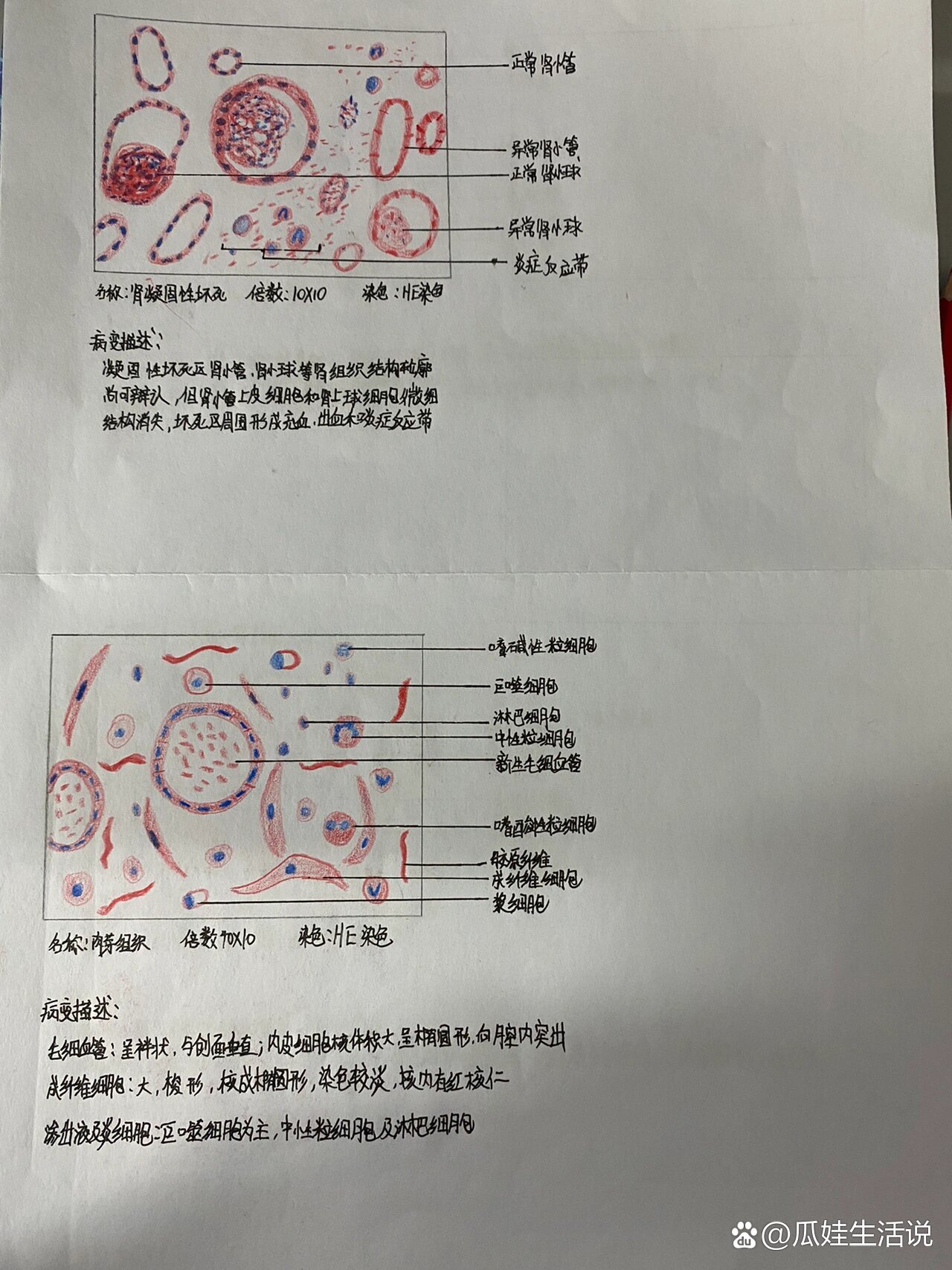 鼻息肉绘图红蓝铅笔图片