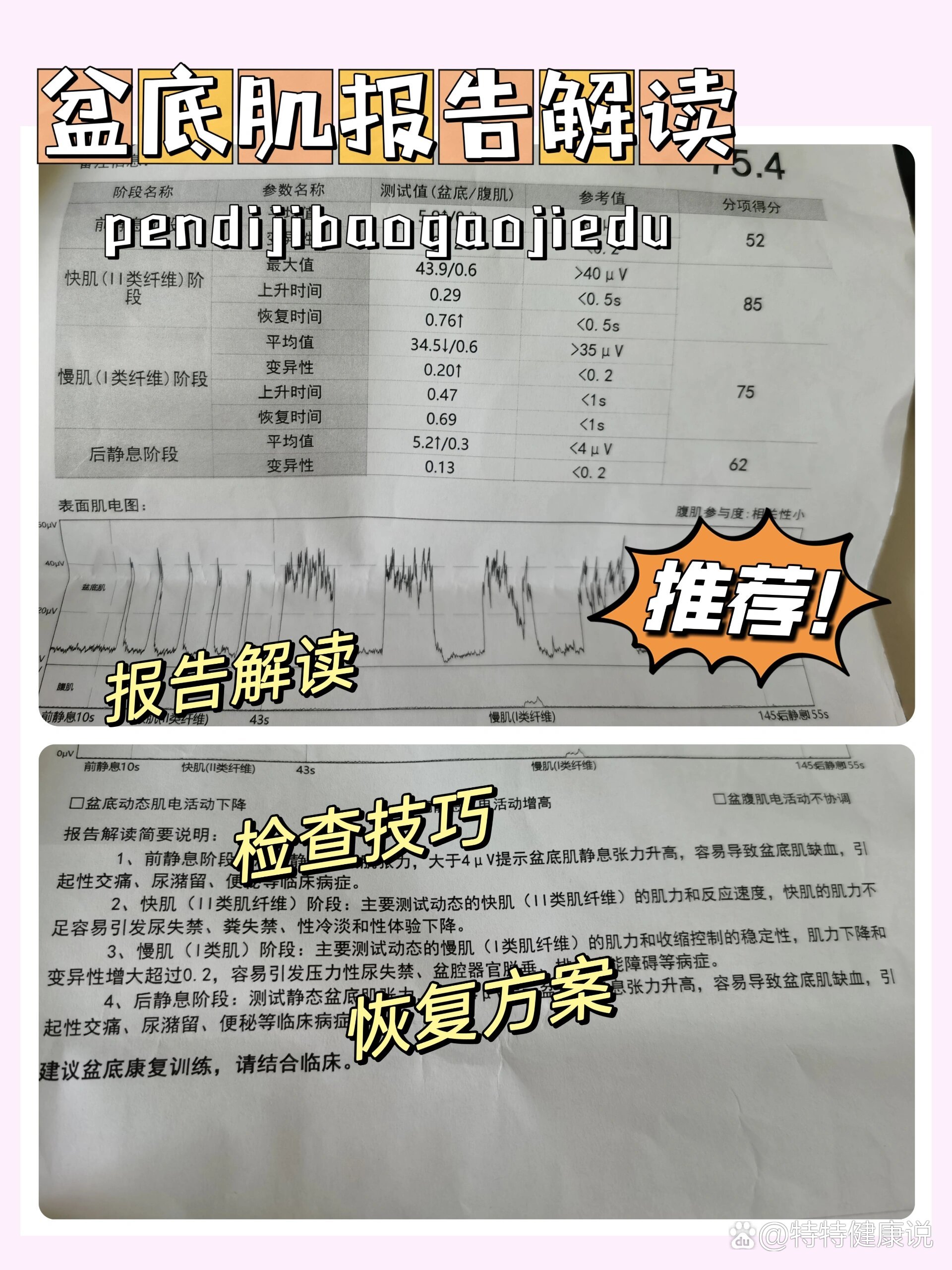 991分钟带你解读盆底肌报告,定方案7515