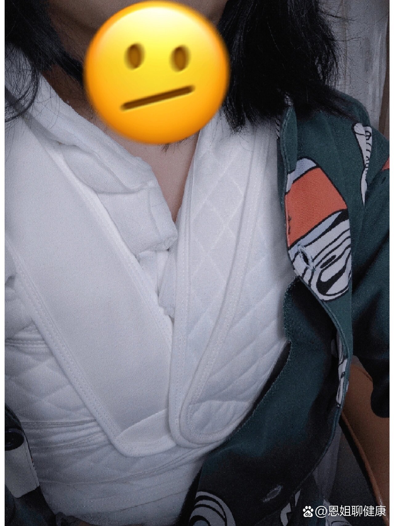 乳腺分叶状肿瘤,良性!