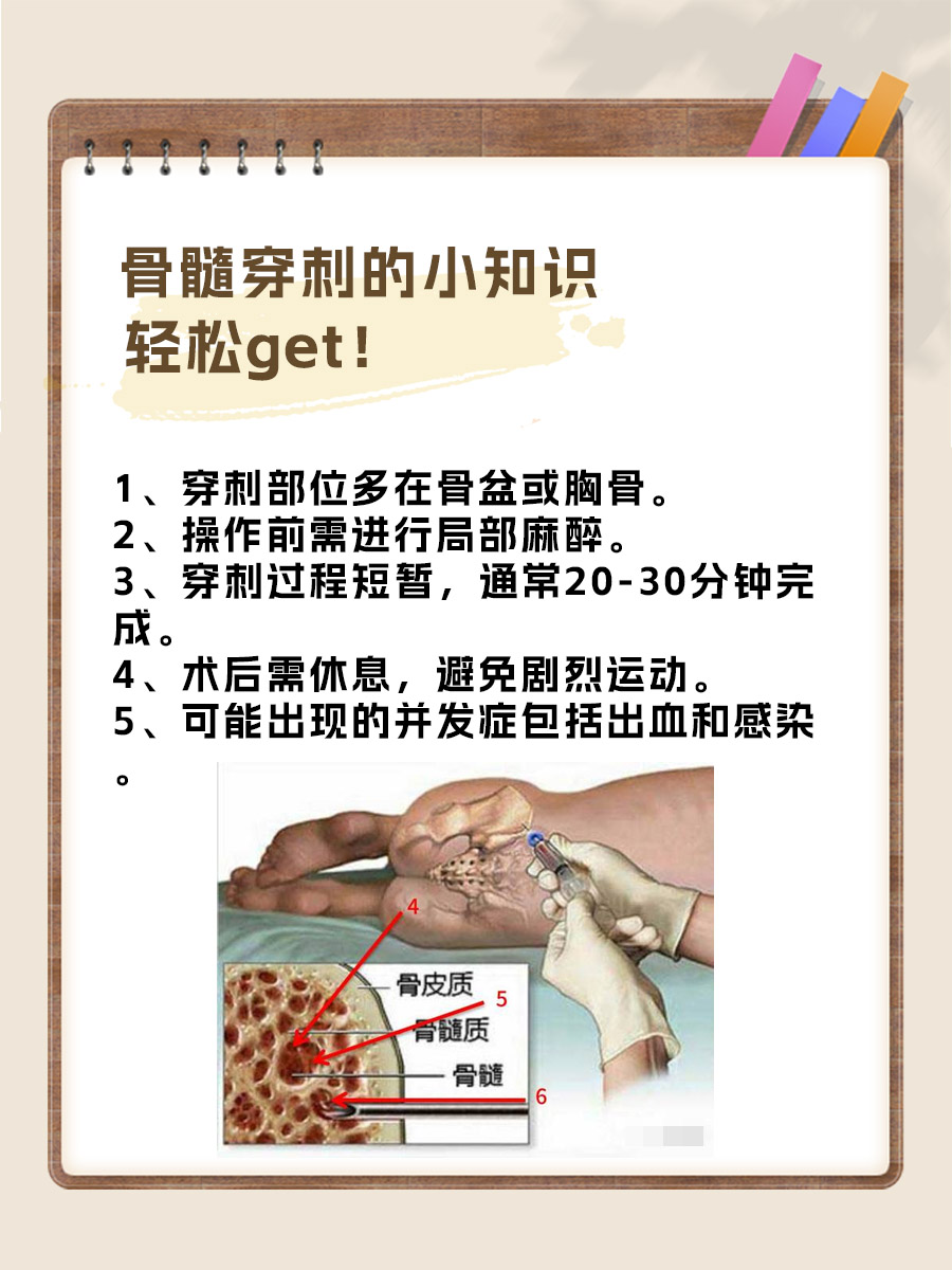 想知道骨髓穿刺能查出什么病?看这篇就对了!