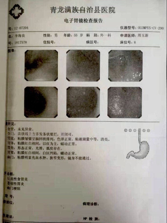 儿童幽门梗阻图片