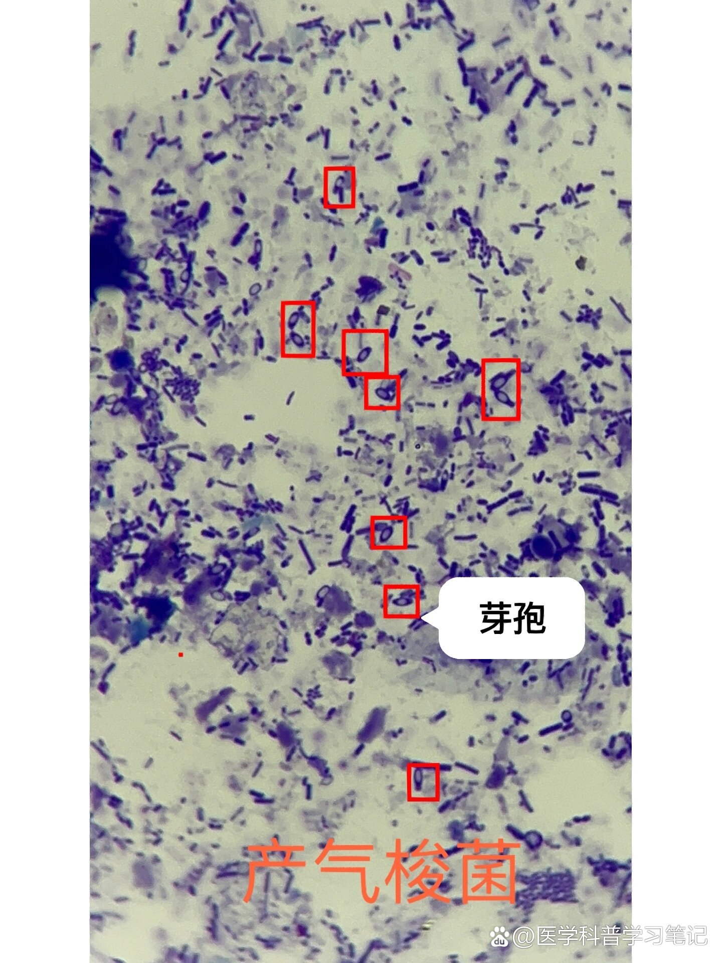 产气荚膜杆菌手绘图图片