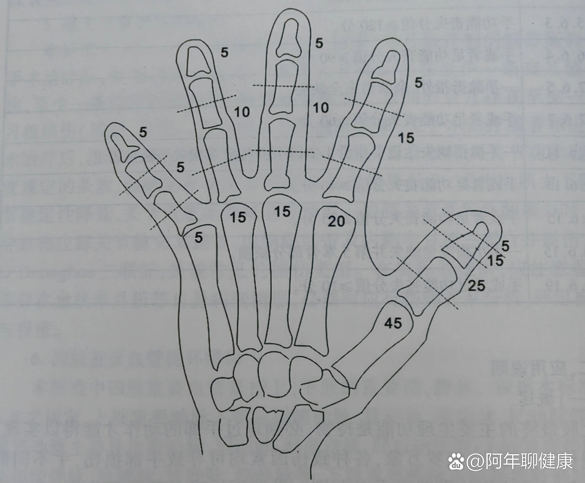 一张图教你怎么判断手指受伤评定伤残