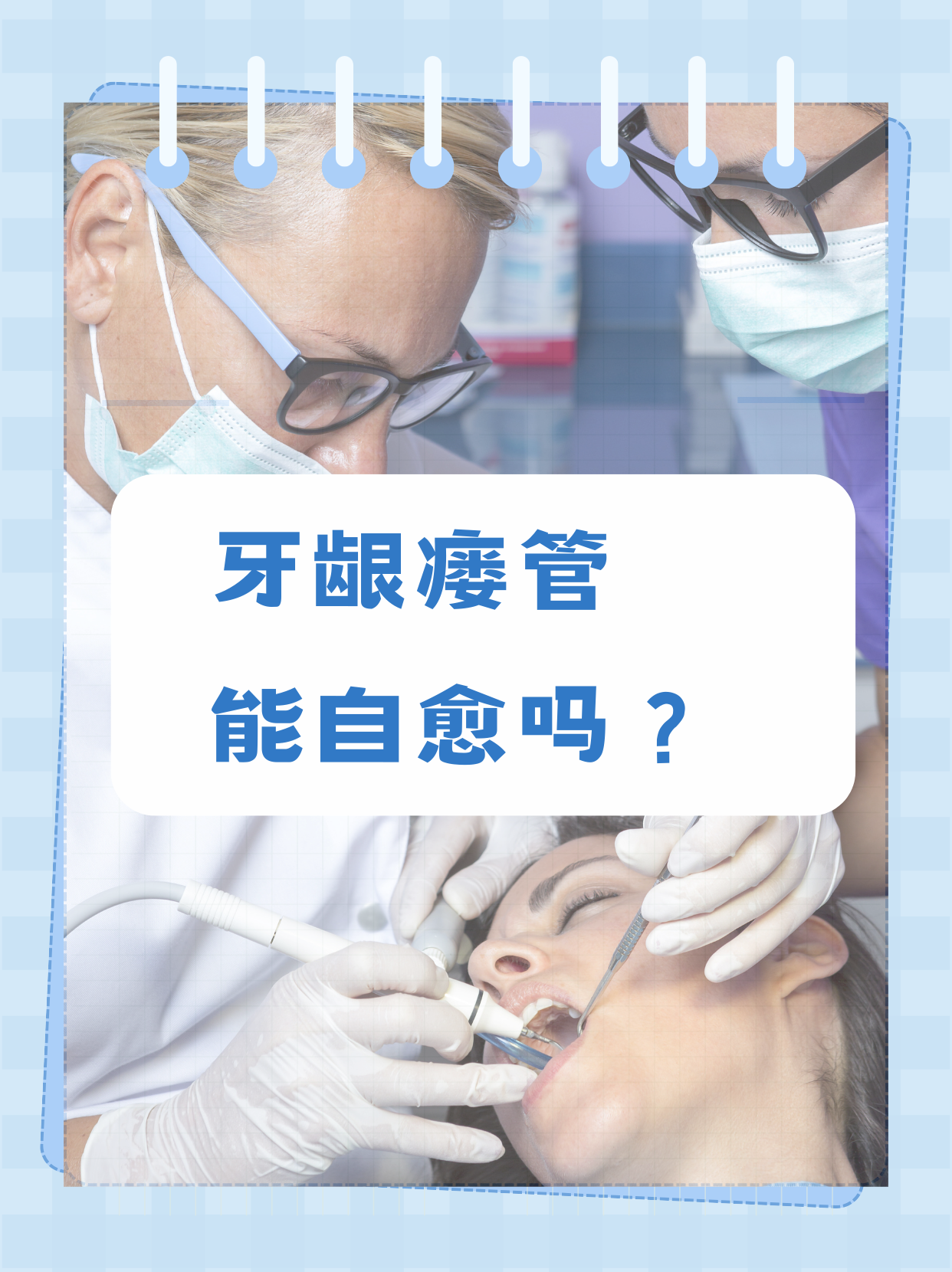 牙龈瘘管能自愈吗?