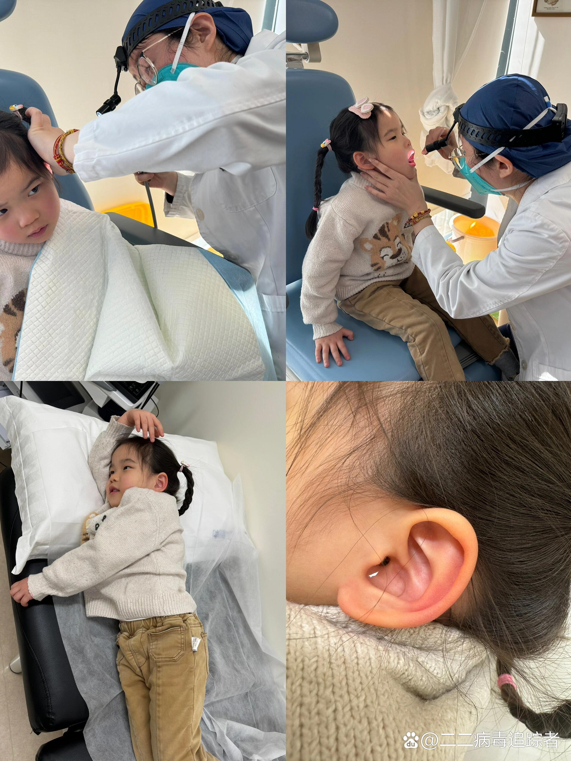 小朋友也是有耳结石的! br>小朋友有天晚上突然喊说耳朵疼.