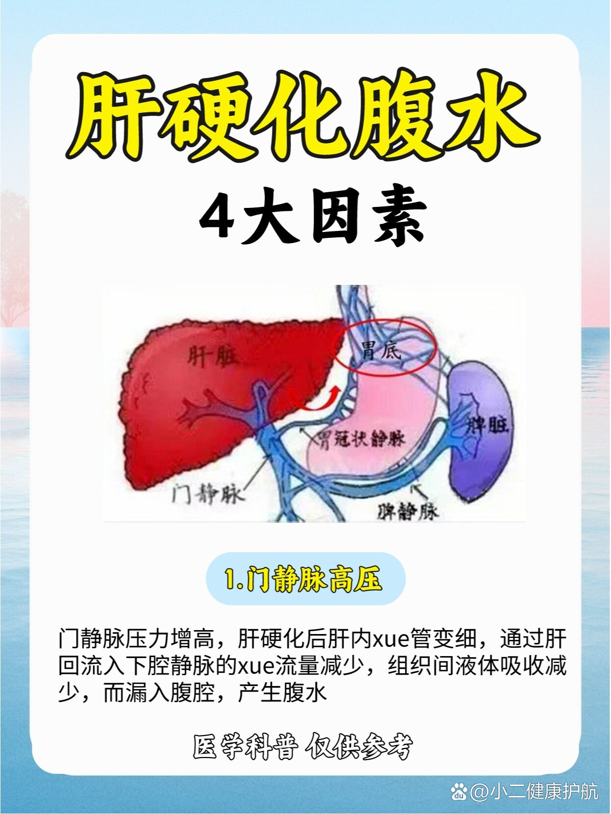 肝硬化产生腹水的4大因素