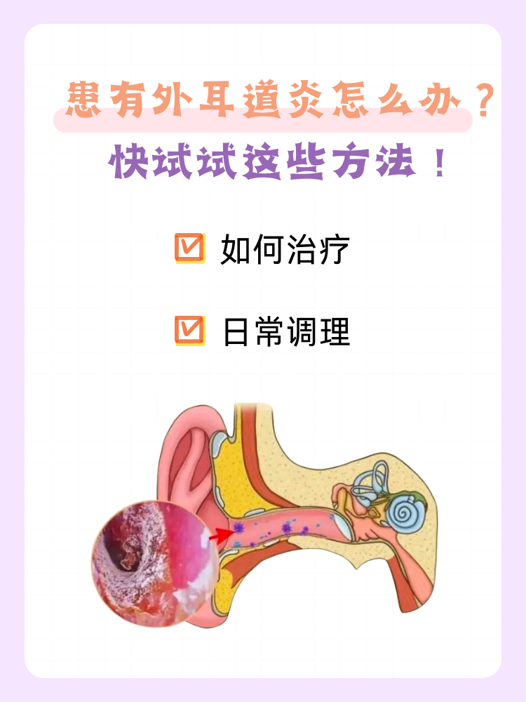 患有外耳道炎怎么办?快试试这些方法!