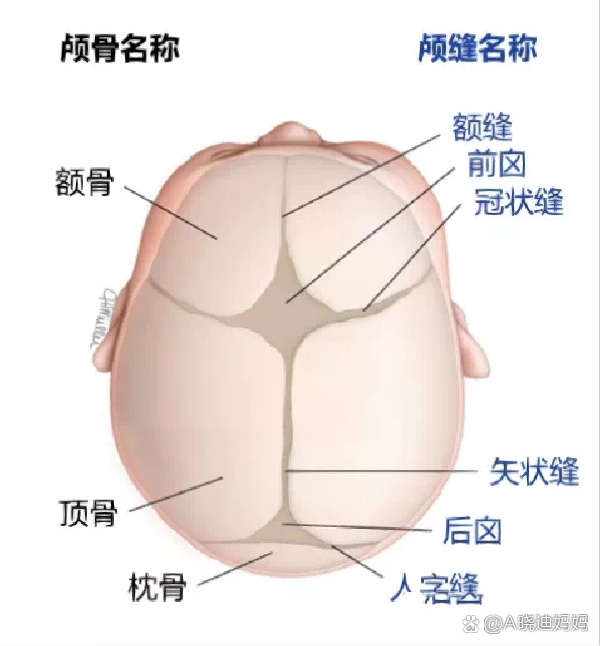 单侧冠状缝早闭图片