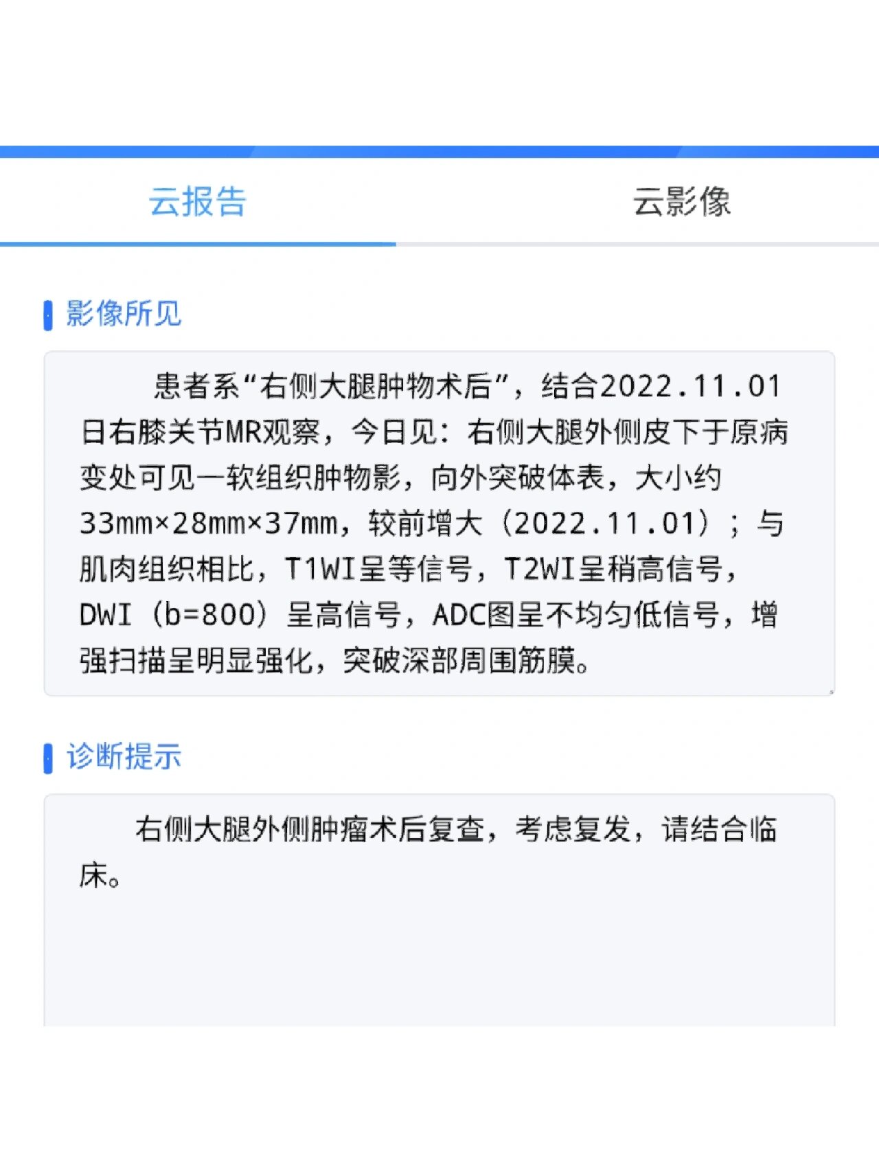 多形性未分化肉瘤