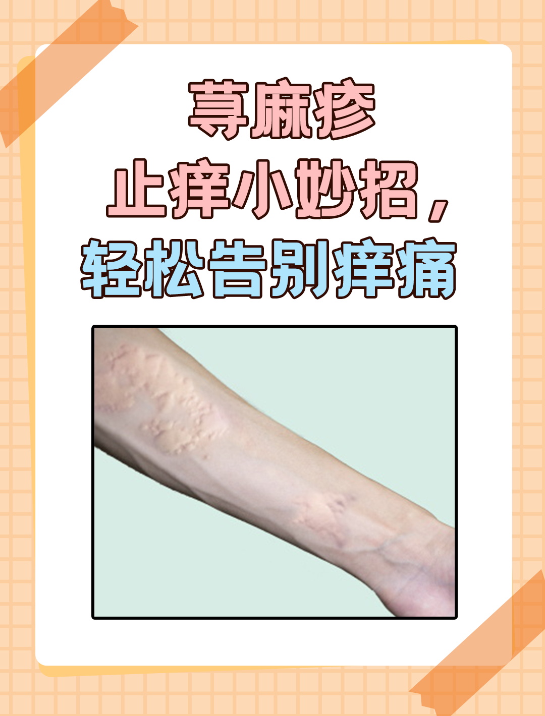 荨麻疹止痒秘籍,一招让你远离痒痛