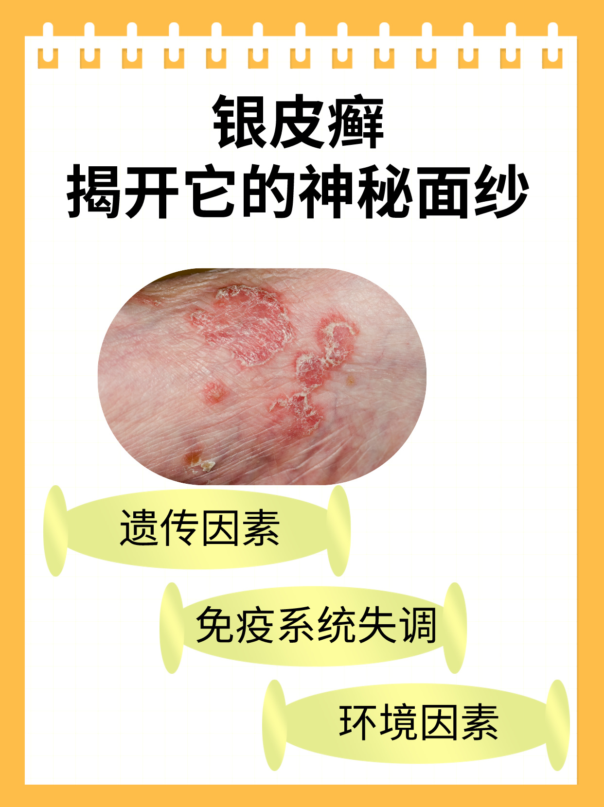 为什么长癣的地方变白百科在线