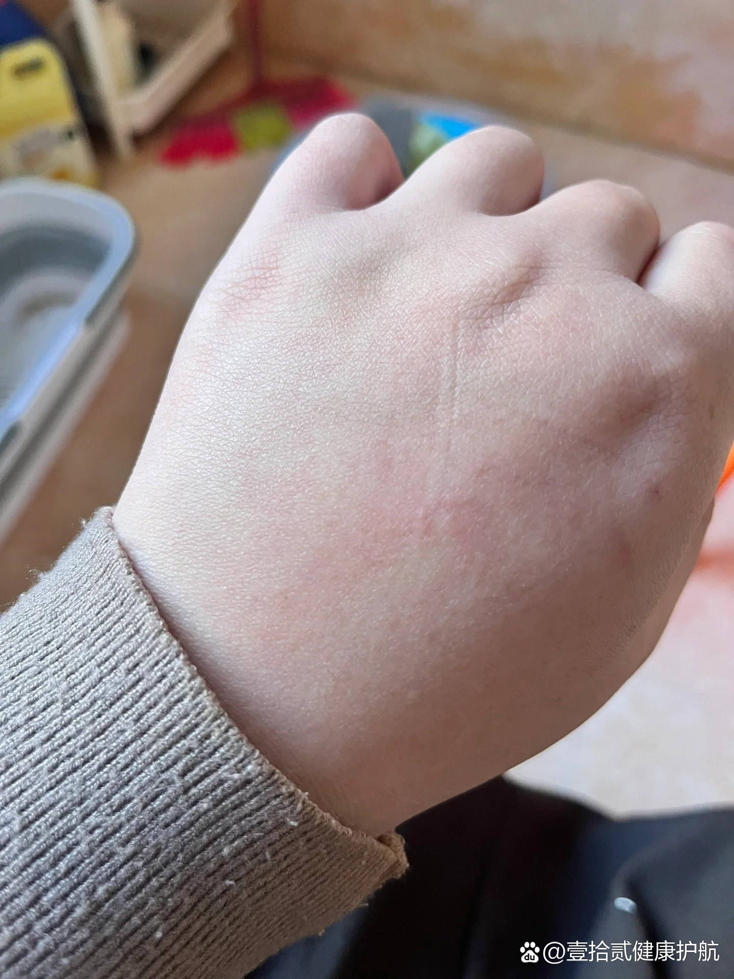 用完欧舒丹沐浴露后就过敏了