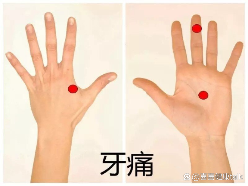 牙痛组穴更有效