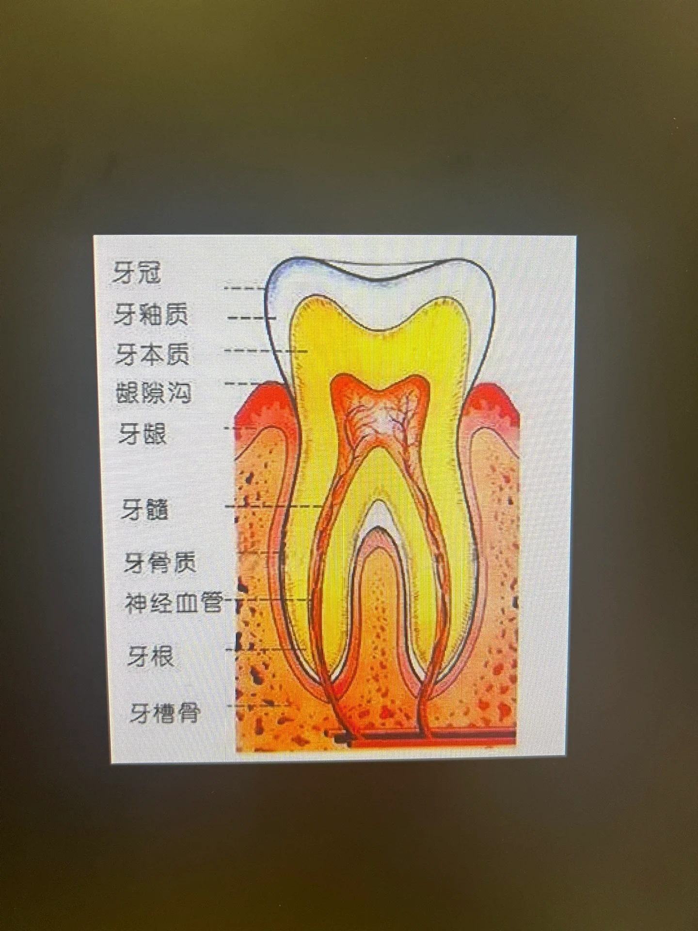 牙齿的名称位置 带图图片