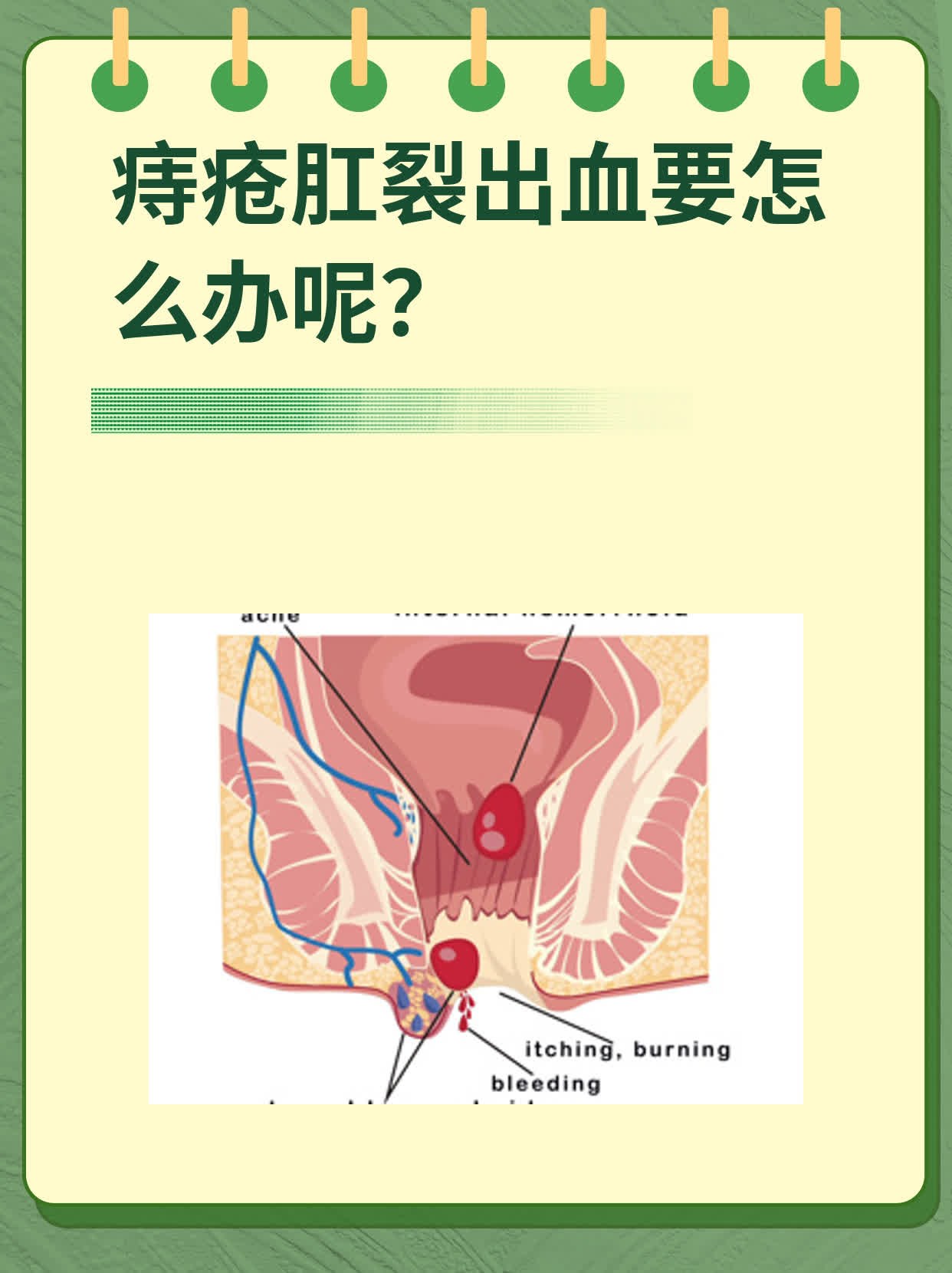 肛裂出血怎么治愈图片图片