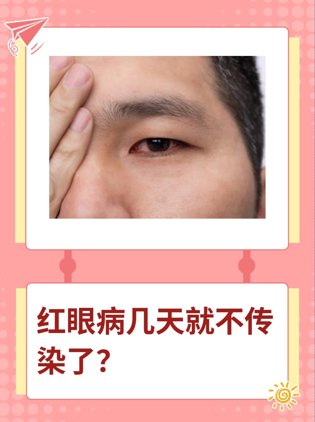 红眼病几天就不传染了?