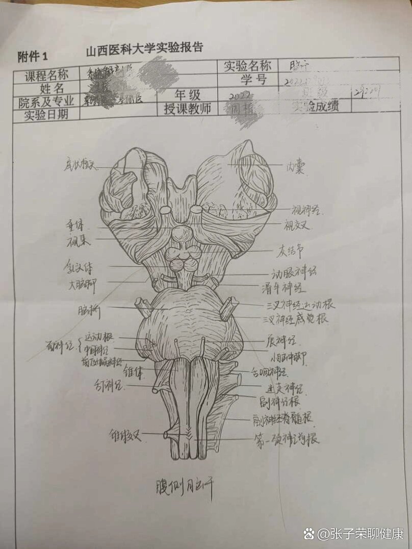 脑干腹侧面图片