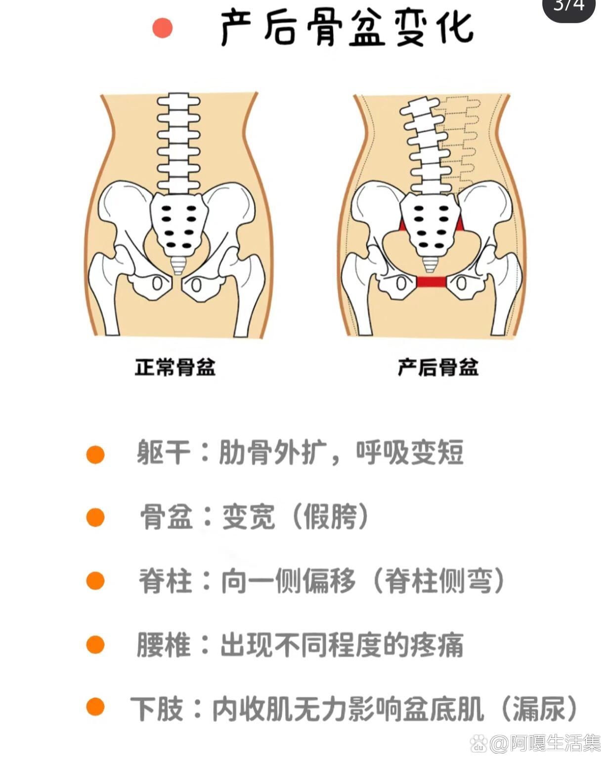 新手瑜伽老师必备‖女性骨盆的解剖知识!