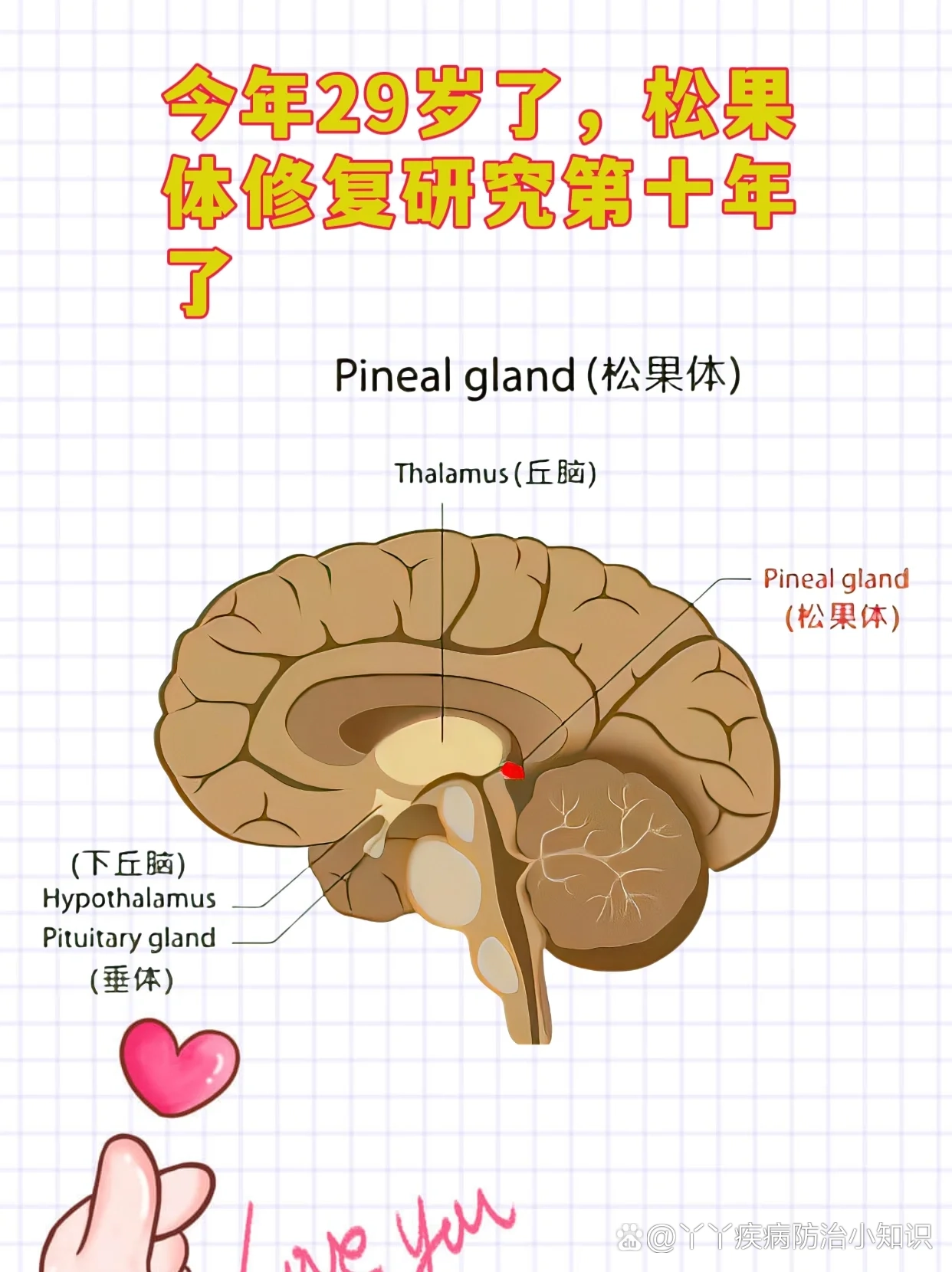 松果体横断图片