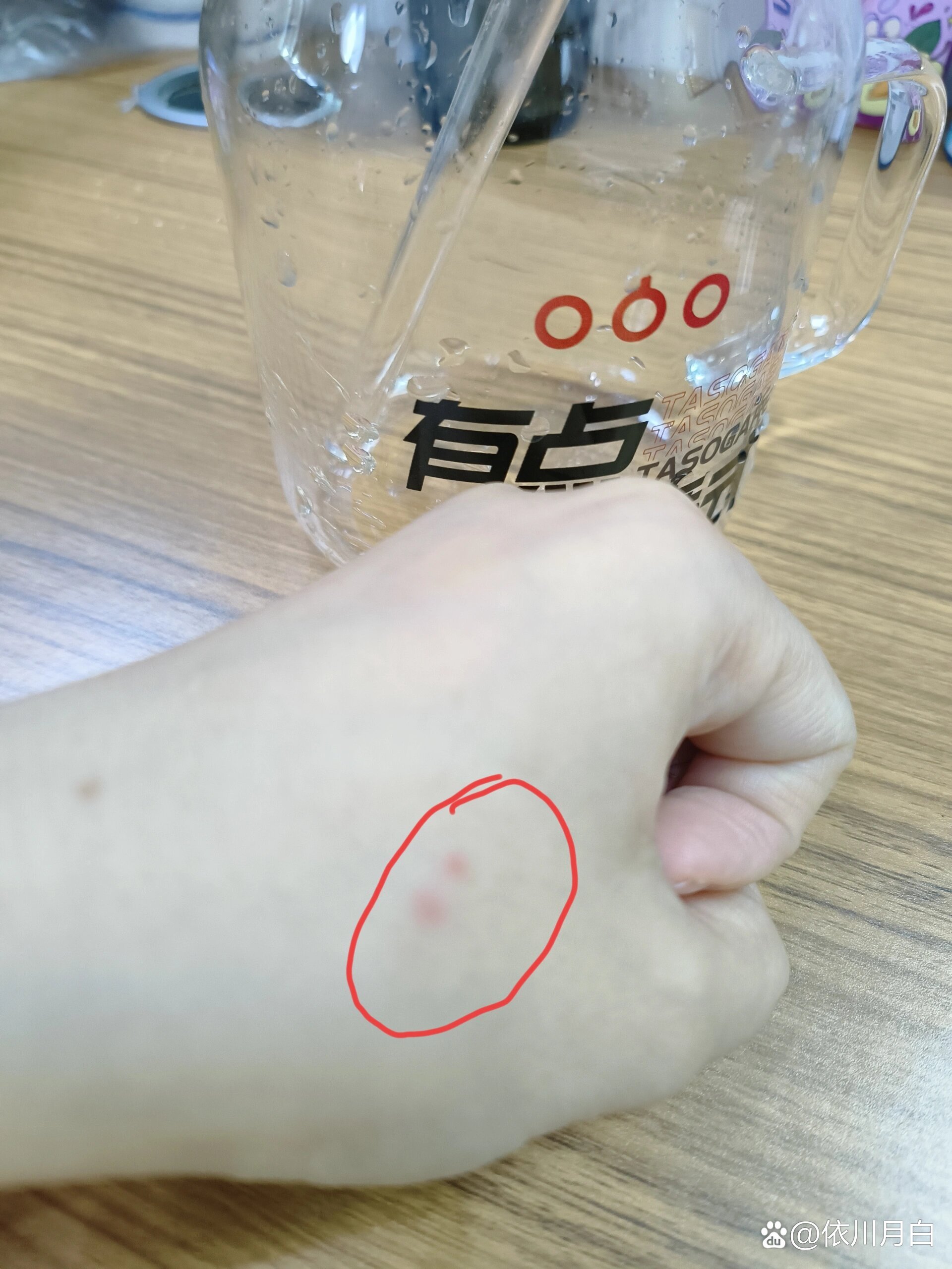 小手上莫名出现两个红点,还有点胀胀的疼01