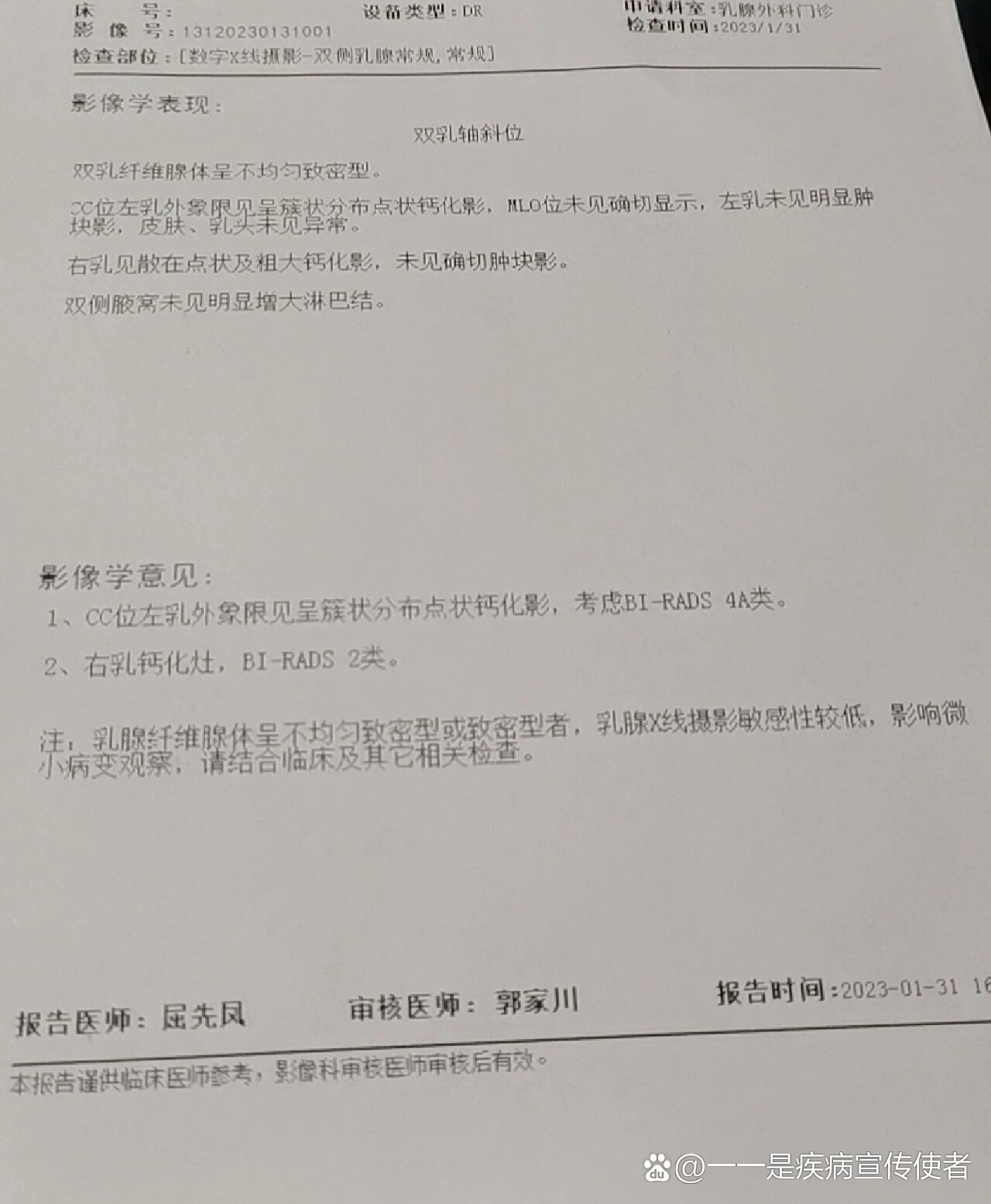 乳腺钼靶检查簇状钙化4a