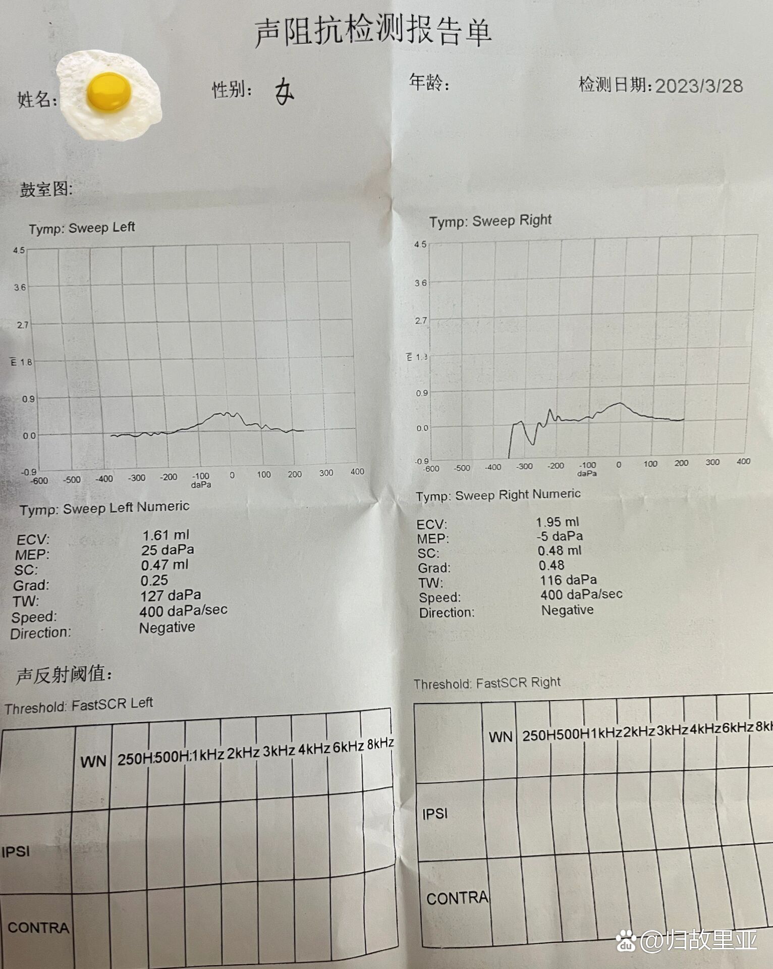 不要再长期戴耳机听歌了!