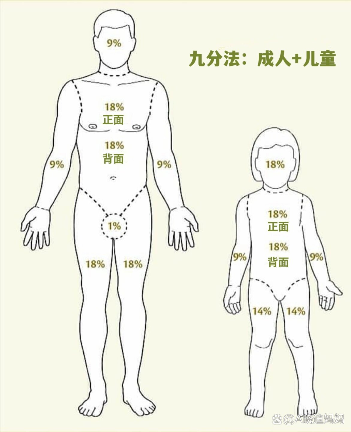 烧伤新九分法图片