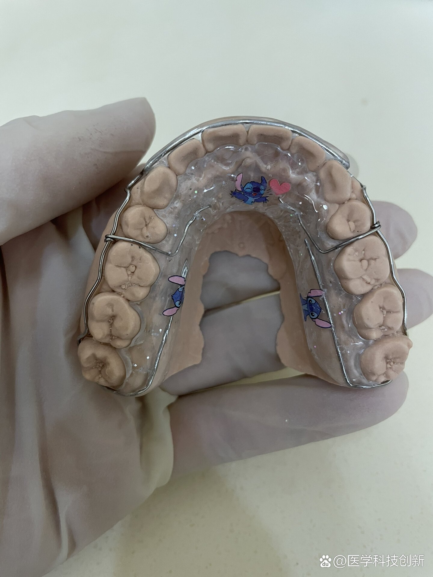 改良型比格保持器
