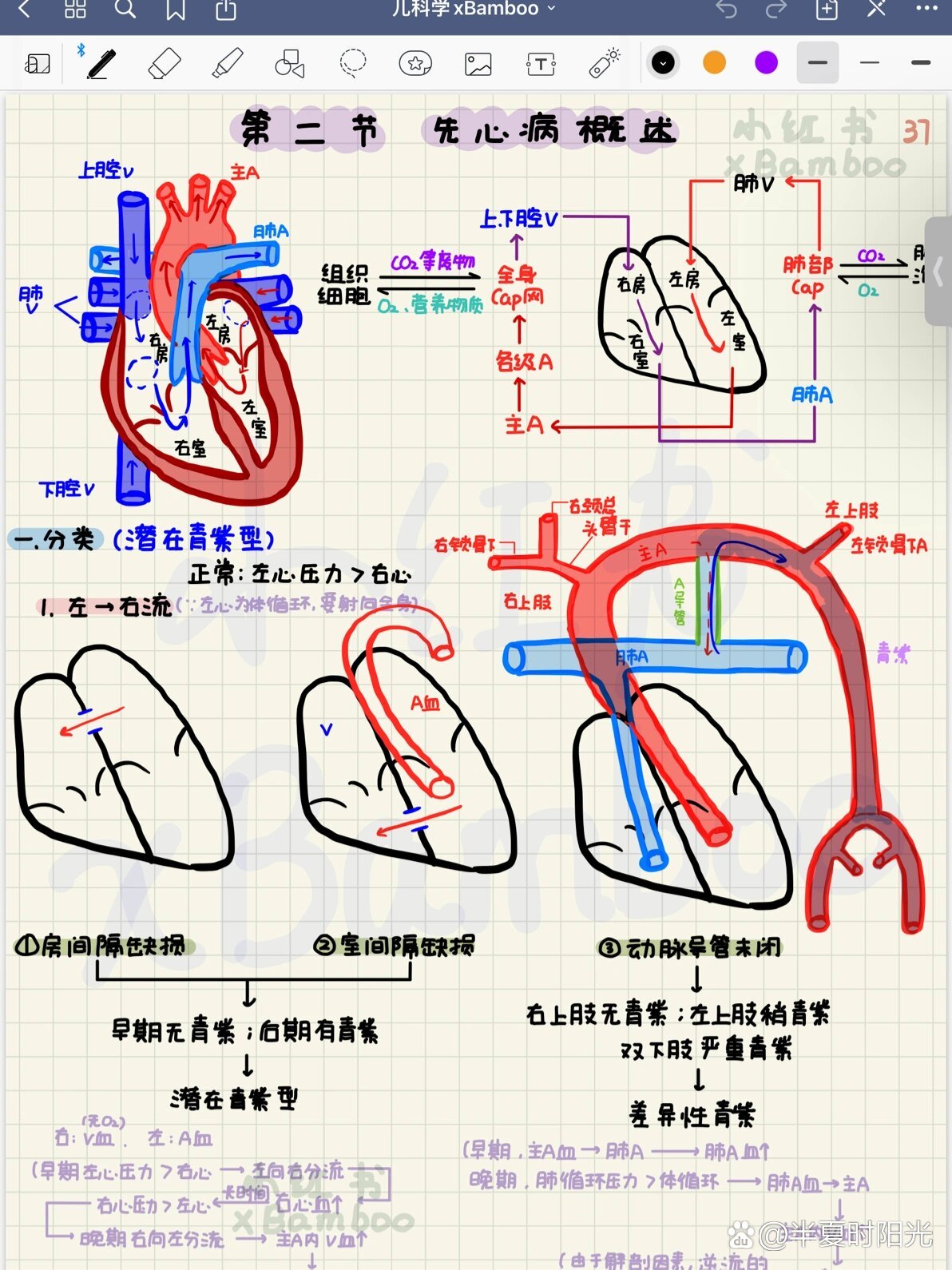 动脉导管未闭解剖位置图片