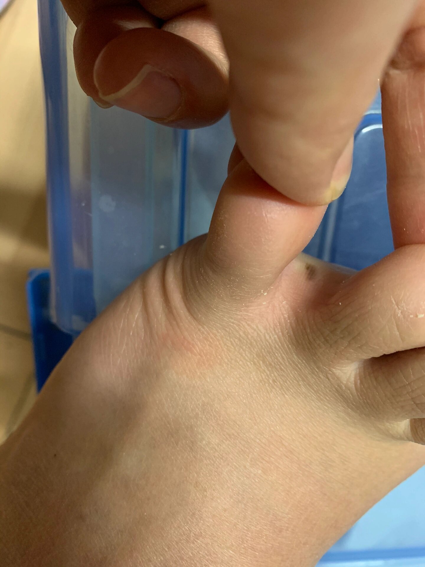 最近突然发现脚上的小拇指下面长了一颗黑色的痣,都35岁的人了还在在